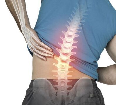 Az alsó hátfájás tüneteinek kezelése A mellkasi gerinc vagy közép háttájéki fájdalom okai